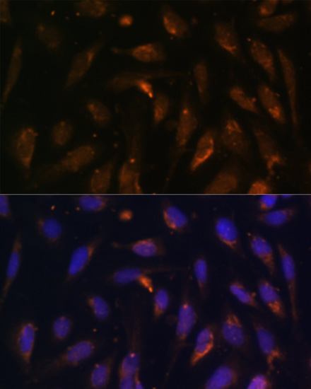 Immunofluorescence - RAB8A Polyclonal Antibody 