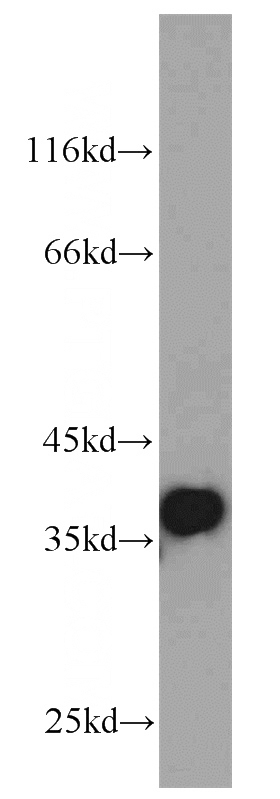mouse skeletal muscle tissue were subjected to SDS PAGE followed by western blot with Catalog No:113537(P15RS antibody) at dilution of 1:1000