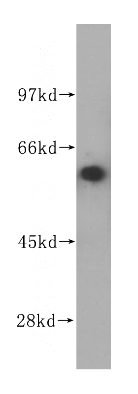 human kidney tissue were subjected to SDS PAGE followed by western blot with Catalog No:108040(NAE1 antibody) at dilution of 1:400