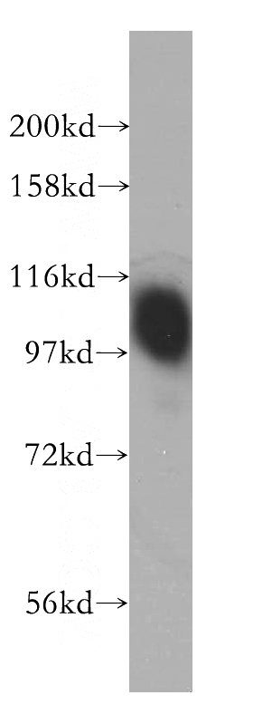 PC-3 cells were subjected to SDS PAGE followed by western blot with Catalog No:109017(CD276 antibody) at dilution of 1:500