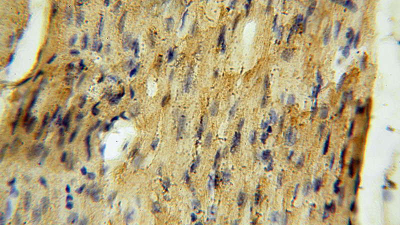 Immunohistochemical of paraffin-embedded human heart using Catalog No:112857(MRPS34 antibody) at dilution of 1:50 (under 40x lens)