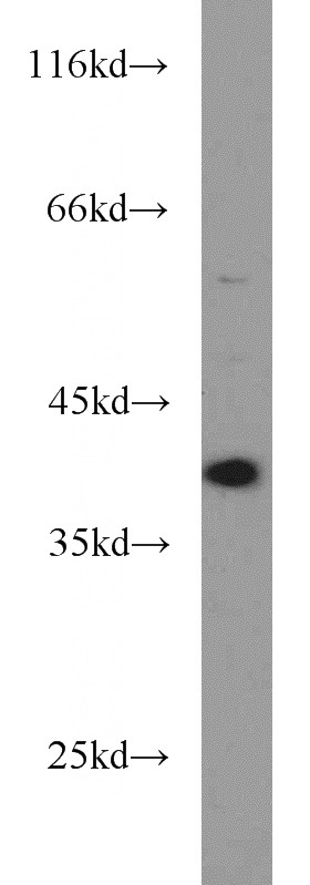 K-562 cells were subjected to SDS PAGE followed by western blot with Catalog No:110078(POLB antibody) at dilution of 1:1000