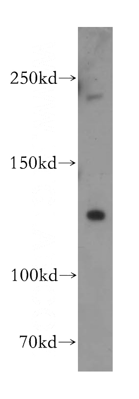 HeLa cells were subjected to SDS PAGE followed by western blot with Catalog No:110541(FBXL13 antibody) at dilution of 1:500