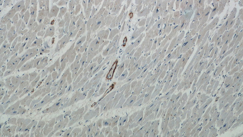 Immunohistochemical of paraffin-embedded human heart using Catalog No:108905(CNN1 antibody) at dilution of 1:50 (under 10x lens)