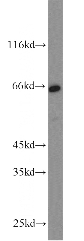 HeLa cells were subjected to SDS PAGE followed by western blot with Catalog No:109130(CD58 antibody) at dilution of 1:500