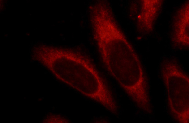 Immunofluorescent analysis of HeLa cells using Catalog No:114684(RELB Antibody) at dilution of 1:25 and Rhodamine-Goat anti-Rabbit IgG