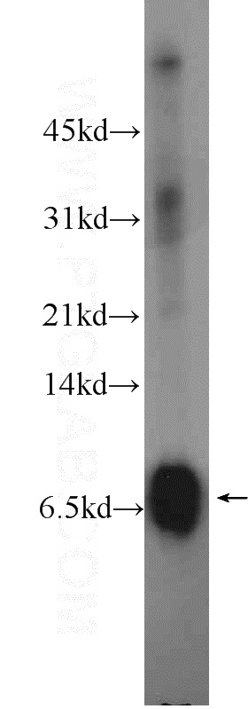 MCF-7 cells were subjected to SDS PAGE followed by western blot with Catalog No:112463(SCGB2A2 Antibody) at dilution of 1:300