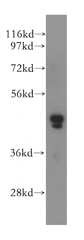 HeLa cells were subjected to SDS PAGE followed by western blot with Catalog No:115256(POLDIP3 antibody) at dilution of 1:500