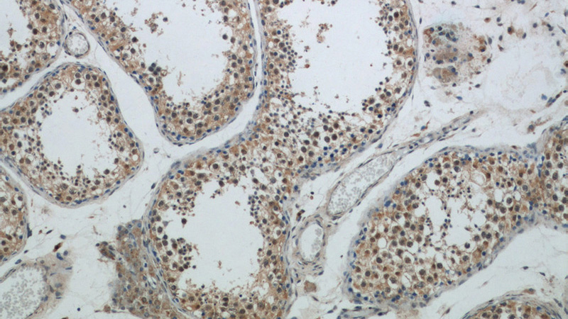 Immunohistochemical of paraffin-embedded human testis using Catalog No:108132(ANAPC1 antibody) at dilution of 1:50 (under 10x lens)