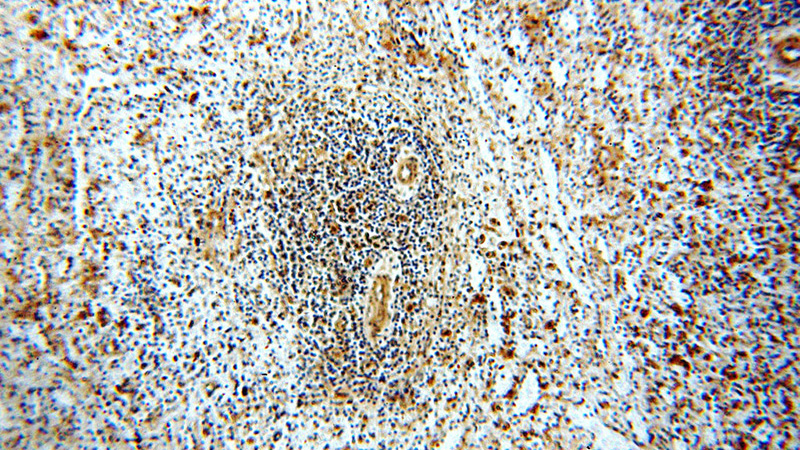 Immunohistochemical of paraffin-embedded human spleen using Catalog No:115696(STAT6 antibody) at dilution of 1:50 (under 10x lens)
