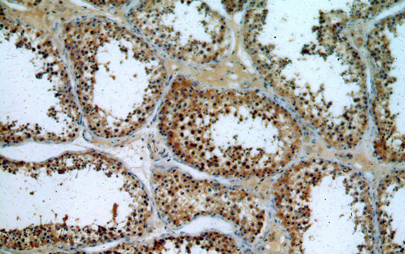 Immunohistochemical of paraffin-embedded human testis using Catalog No:112792(MTOR antibody) at dilution of 1:50 (under 10x lens)