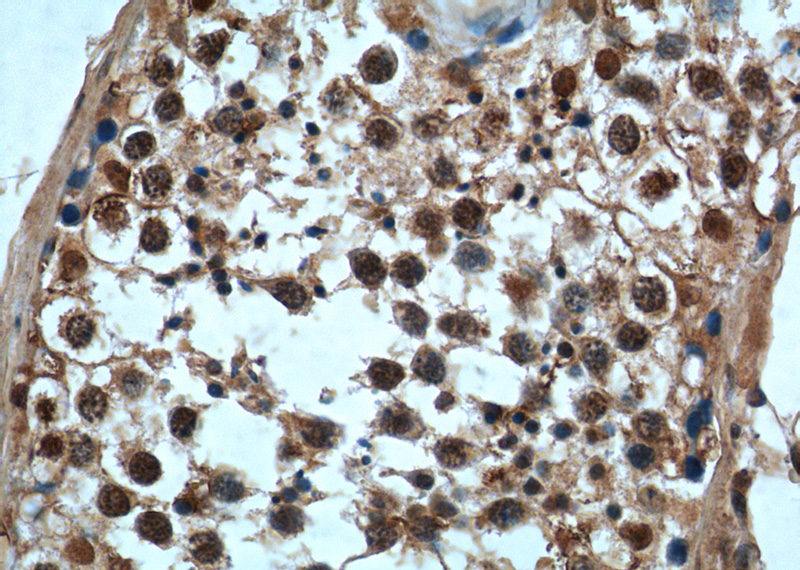 Immunohistochemistry of paraffin-embedded human testis tissue slide using Catalog No:108995(CCHCR1 Antibody) at dilution of 1:50 (under 40x lens)