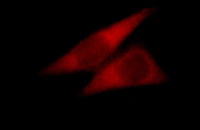 Immunofluorescent analysis of Hela cells, using CYTH2 antibody Catalog No:109788 at 1:25 dilution and Rhodamine-labeled goat anti-rabbit IgG (red).