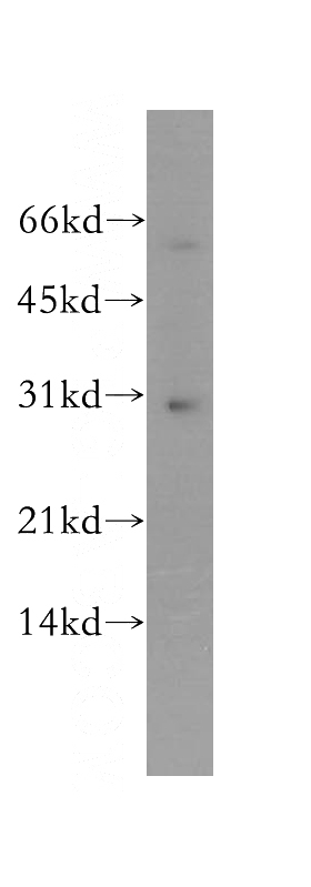 human liver tissue were subjected to SDS PAGE followed by western blot with Catalog No:116886(YIPF5 antibody) at dilution of 1:500