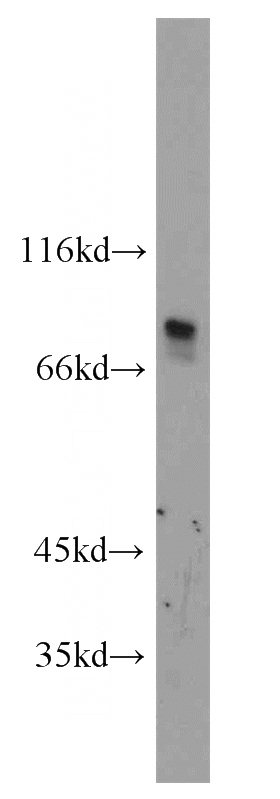 HepG2 cells were subjected to SDS PAGE followed by western blot with Catalog No:114711(RINT1 antibody) at dilution of 1:500