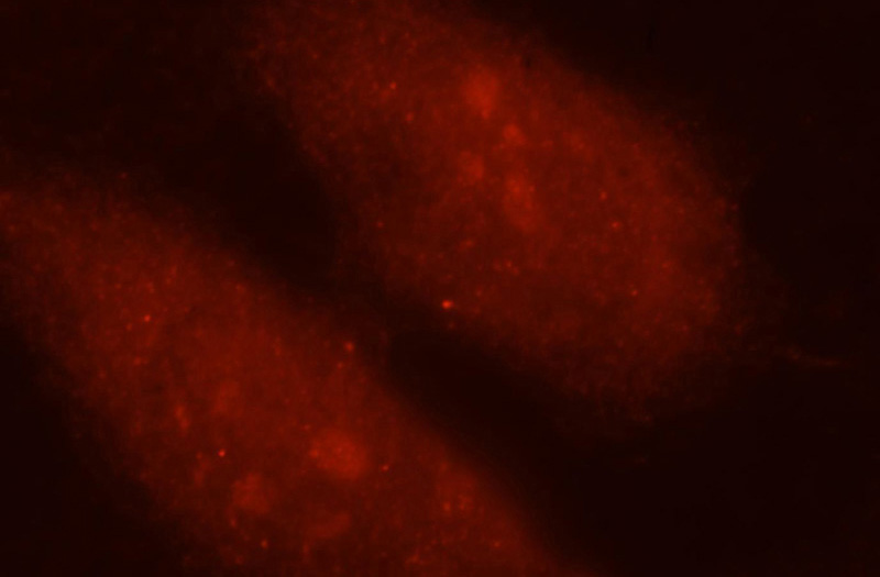 Immunofluorescent analysis of MCF-7 cells, using ANXA10 antibody Catalog No:108090 at 1:25 dilution and Rhodamine-labeled goat anti-rabbit IgG (red).