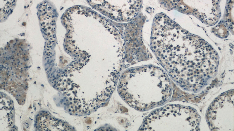 Immunohistochemistry of paraffin-embedded human testis tissue slide using Catalog No:110472(FAM133A Antibody) at dilution of 1:50 (under 10x lens)