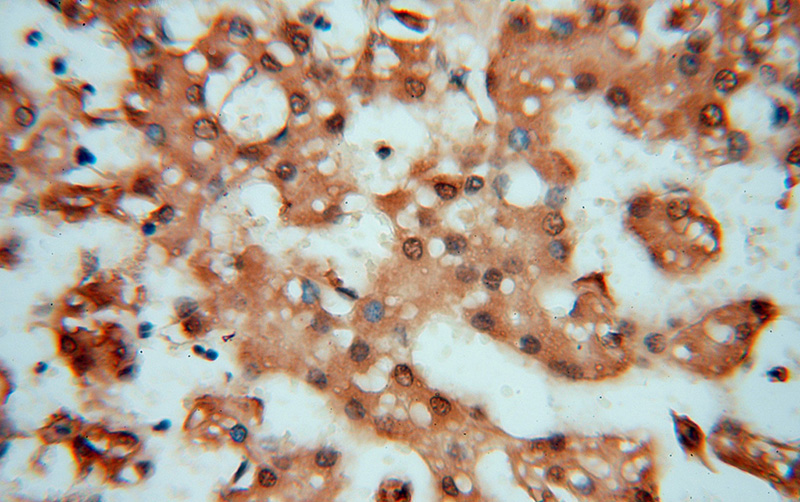 Immunohistochemical of paraffin-embedded human liver using Catalog No:114383(PSMB3 antibody) at dilution of 1:50 (under 40x lens)