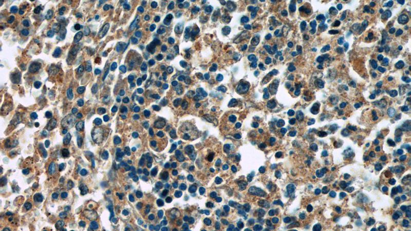 Immunohistochemistry of paraffin-embedded human spleen tissue slide using Catalog No:110367(ERMP1 Antibody) at dilution of 1:50 (under 40x lens)