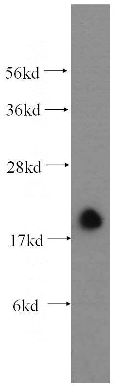 mouse kidney tissue were subjected to SDS PAGE followed by western blot with Catalog No:112757(MPV17 antibody) at dilution of 1:500