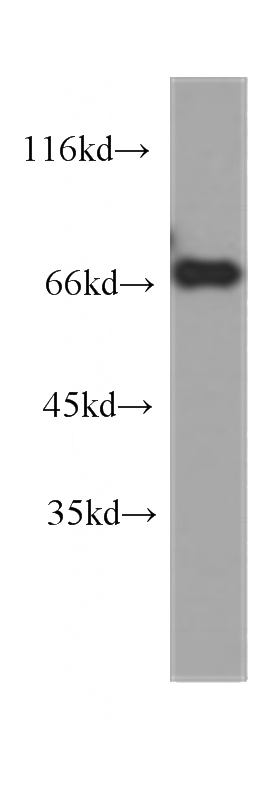 Jurkat cells were subjected to SDS PAGE followed by western blot with Catalog No:107546(ZAP70 antibody) at dilution of 1:1000