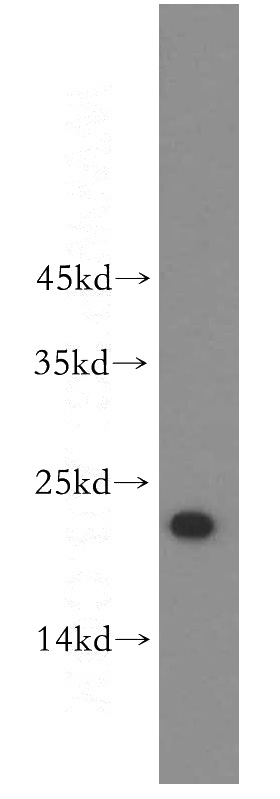 Jurkat cells were subjected to SDS PAGE followed by western blot with Catalog No:116524(UBE2F antibody) at dilution of 1:500