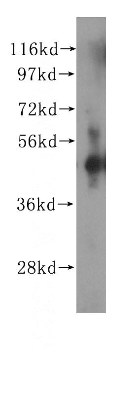 human spleen tissue were subjected to SDS PAGE followed by western blot with Catalog No:116958(ZNF2 antibody) at dilution of 1:500