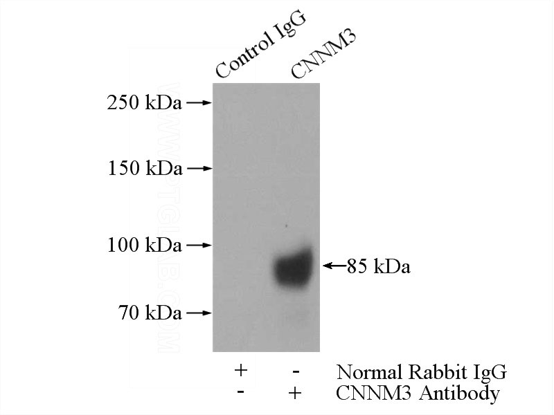 IP Result of anti-CNNM3 (IP:Catalog No:109429, 4ug; Detection:Catalog No:109429 1:500) with K-562 cells lysate 3600ug.