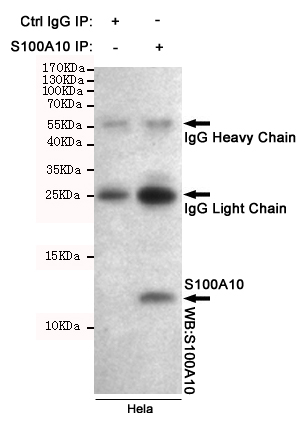 Immunoprecipitation analysis of Hela cell lysates using S100A10 mouse mAb.