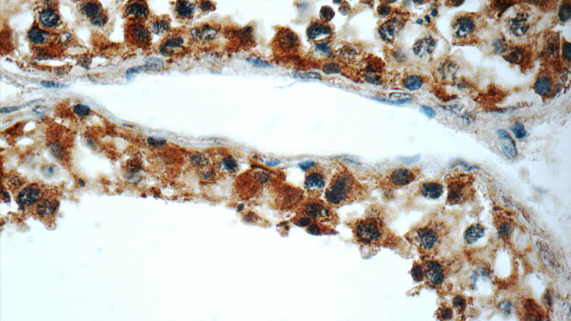Immunohistochemistry of paraffin-embedded human testis slide using Catalog No:112144(LARG Antibody) at dilution of 1:50