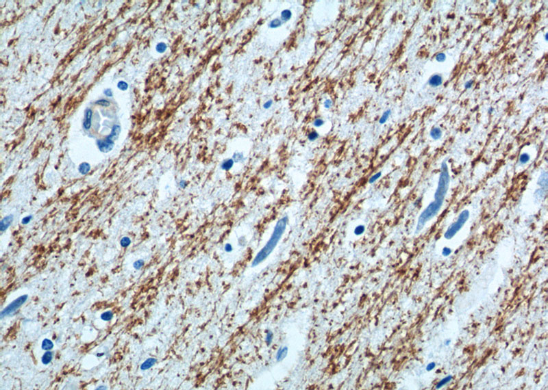 Immunohistochemistry of paraffin-embedded human brain tissue slide using Catalog No:112375(MAG Antibody) at dilution of 1:200 (under 40x lens).
