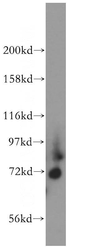 human heart tissue were subjected to SDS PAGE followed by western blot with Catalog No:112258(KCND1 antibody) at dilution of 1:300
