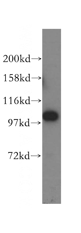 human brain tissue were subjected to SDS PAGE followed by western blot with Catalog No:112710(MMS19 antibody) at dilution of 1:500