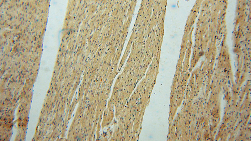 Immunohistochemical of paraffin-embedded human heart using Catalog No:113567(PAN2 antibody) at dilution of 1:50 (under 10x lens)