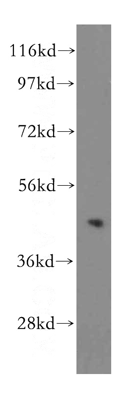 HeLa cells were subjected to SDS PAGE followed by western blot with Catalog No:116295(TRIB2 antibody) at dilution of 1:500