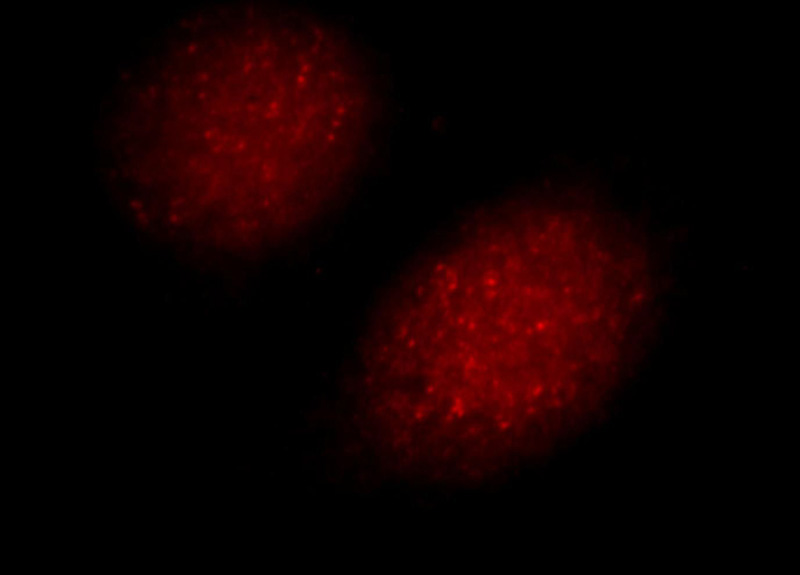 Immunofluorescent analysis of Hela cells, using UIMC1 antibody Catalog No:116565 at 1:25 dilution and Rhodamine-labeled goat anti-rabbit IgG (red).