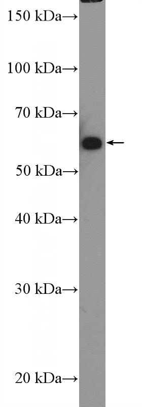 DU 145 cells were subjected to SDS PAGE followed by western blot with Catalog No:111199(GRB14 Antibody) at dilution of 1:600