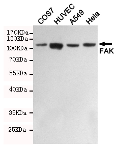 Western blot detection of FAK in COS7,HUVEC,A549 and Hela cell lysates using FAK mouse mAb (1:1000 diluted).Predicted band size: 125KDa.Observed band size:125KDa.