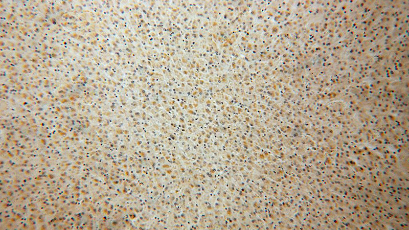Immunohistochemical of paraffin-embedded human liver using Catalog No:115426(SMAP2 antibody) at dilution of 1:50 (under 10x lens)