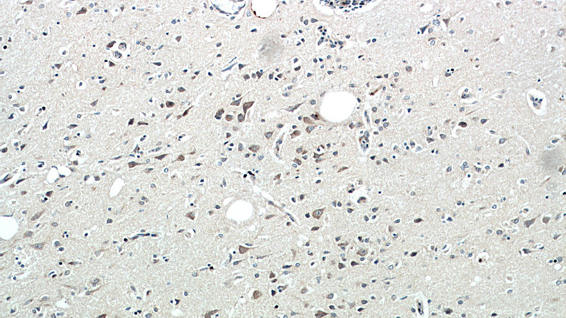 Immunohistochemical of paraffin-embedded human brain using Catalog No:115966(TAC1 antibody) at dilution of 1:50 (under 10x lens)