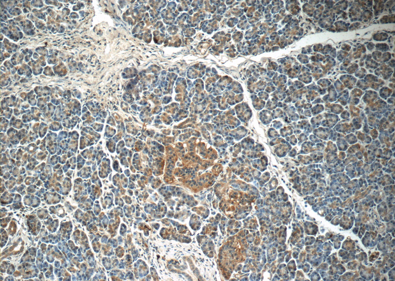 Immunohistochemistry of paraffin-embedded human pancreas tissue slide using Catalog No:108151(ARMC7 Antibody) at dilution of 1:50 (under 10x lens)