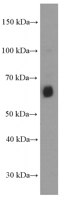 human spleen tissue were subjected to SDS PAGE followed by western blot with Catalog No:107564(AIRE Antibody) at dilution of 1:2000