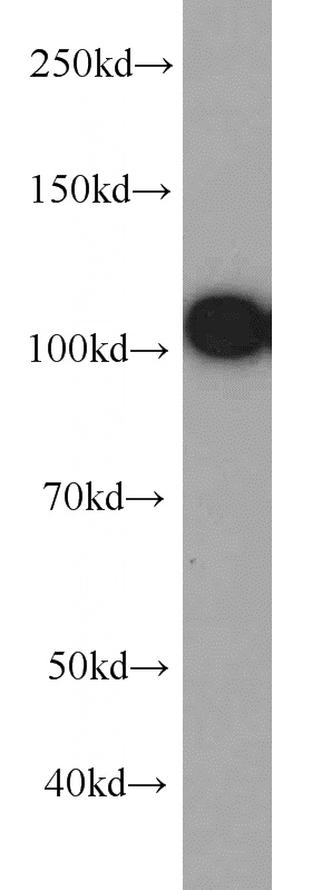 COLO 320 cells were subjected to SDS PAGE followed by western blot with Catalog No:107191(LIMA1 antibody) at dilution of 1:1000