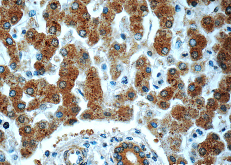 Immunohistochemistry of paraffin-embedded human liver tissue slide using Catalog No:113819(PHKA2 Antibody) at dilution of 1:50 (under 40x lens)