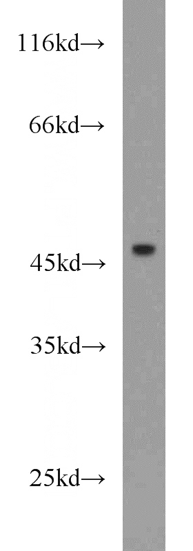HEK-293 cells were subjected to SDS PAGE followed by western blot with Catalog No:111766(IL17RC antibody) at dilution of 1:200
