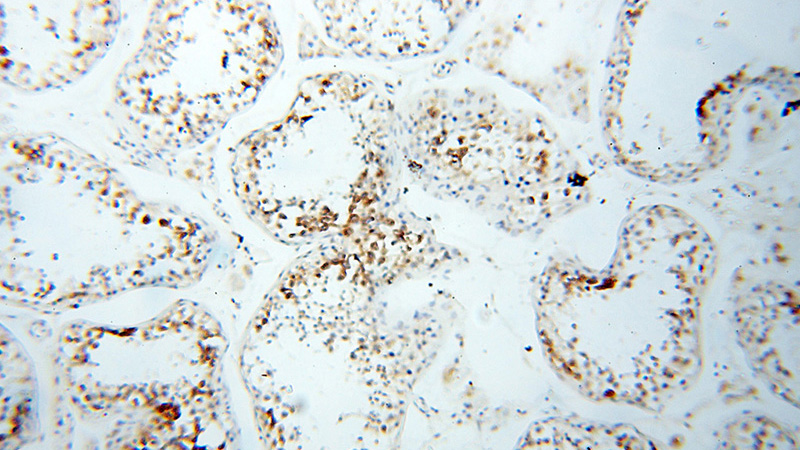 Immunohistochemical of paraffin-embedded human testis using Catalog No:111014(GOLGA2,GM130 antibody) at dilution of 1:100 (under 10x lens)