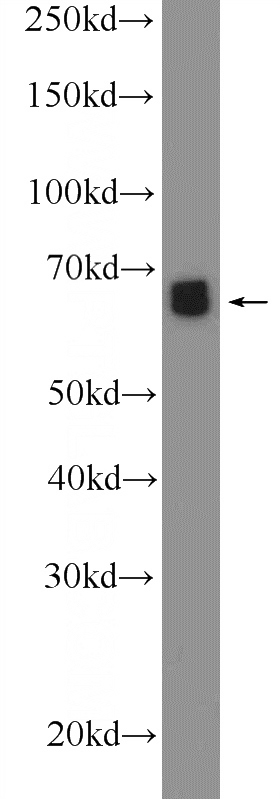 HepG2 cells were subjected to SDS PAGE followed by western blot with Catalog No:110391(EPOR Antibody) at dilution of 1:1000