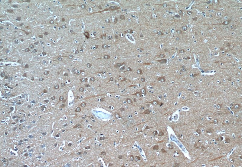 Immunohistochemistry of paraffin-embedded human brain tissue slide using Catalog No:110582(FAM19A5 Antibody) at dilution of 1:50 (under 10x lens)