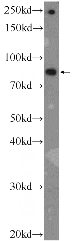 HeLa cells were subjected to SDS PAGE followed by western blot with Catalog No:108862(ATPGD1 Antibody) at dilution of 1:300
