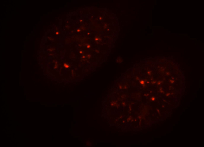 Immunofluorescent analysis of HepG2 cells, using CCNY antibody Catalog No:109071 at 1:25 dilution and Rhodamine-labeled goat anti-rabbit IgG (red).